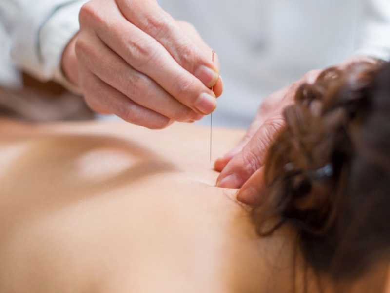 Treating Anxiety and Depression with Acupuncture
