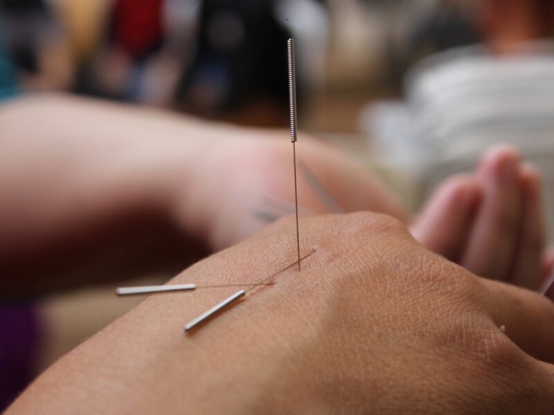 The 3 Important Steps To Set Up An Acupuncture Studio
