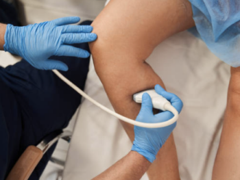 Cosmetic Treatments for Varicose Veins: Say Goodbye to Unwanted Veins