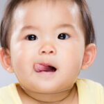 Tongue Tie In Babies: Should You Treat It Early Or Wait?