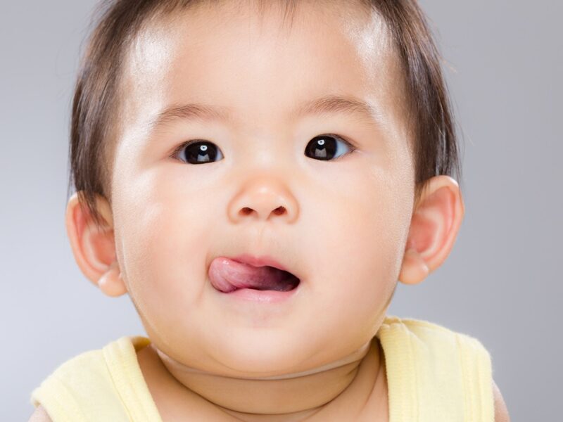 Tongue Tie In Babies: Should You Treat It Early Or Wait?